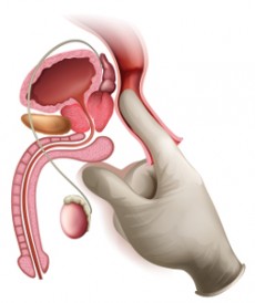 Lage der Prostata. © blueringmedia, istockphoto.com